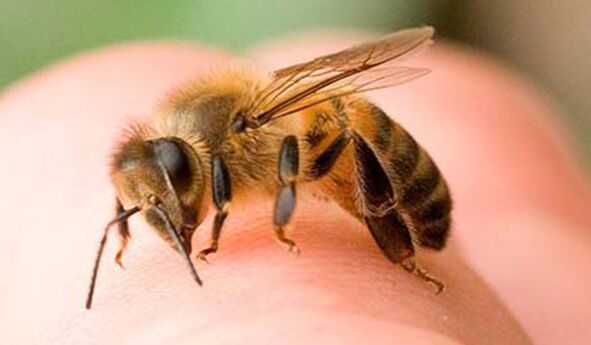 ფუტკრის ნაკბენი - ფალოსის გადიდების ექსტრემალური საშუალება